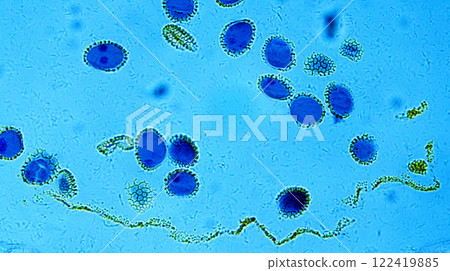 Lillium anther 122419885