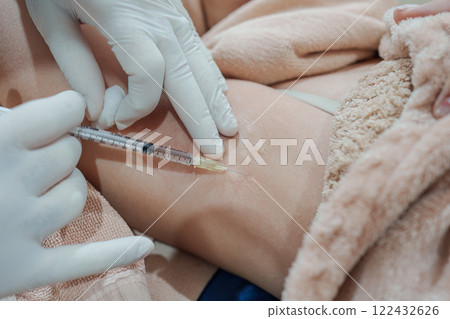 Medical specialist injecting syringe bacterial toxin botulin into armpit for reduce body odor and wrinkles Medical specialist injecting syringe bacterial toxin botulin into armpit for reduce body odor and wrinkles 122432626