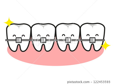 A well-aligned mouth during orthodontic treatment 122453593