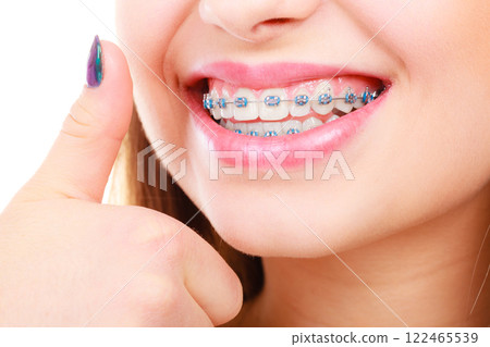 Woman showing her teeth with braces Woman showing her teeth with braces 122465539
