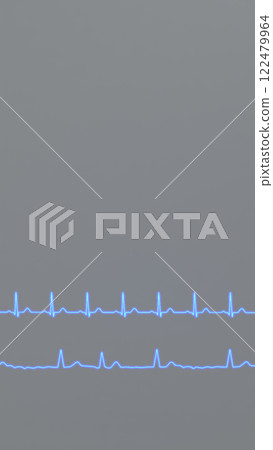 Normal Heart Rhythm ECG and Atrial Fibrillation Normal Heart Rhythm ECG and Atrial Fibrillation 122479964