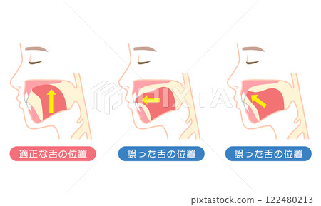 正確的舌位與錯誤的舌位Muing 正確的舌位與錯誤的舌位Muing 122480213