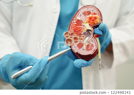 Chronic kidney disease, doctor with model for treatment urinary system, urology, Estimated glomerular filtration rate eGFR. 122498141