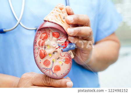Chronic kidney disease, doctor with model for treatment urinary system, urology, Estimated glomerular filtration rate eGFR. Chronic kidney disease, doctor with model for treatment urinary system, urology, Estimated glomerular filtration rate eGFR. 122498152
