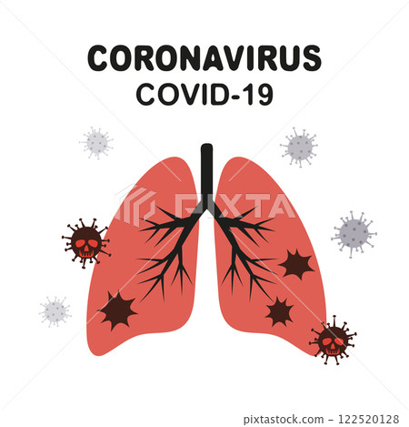 2019-nCoV virus vector illustration. Coronavirus infected human lungs 122520128