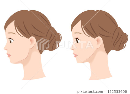 Profile of a woman with a prominent jawline: before and after 122533606