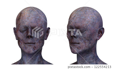Male zombie face 122554213