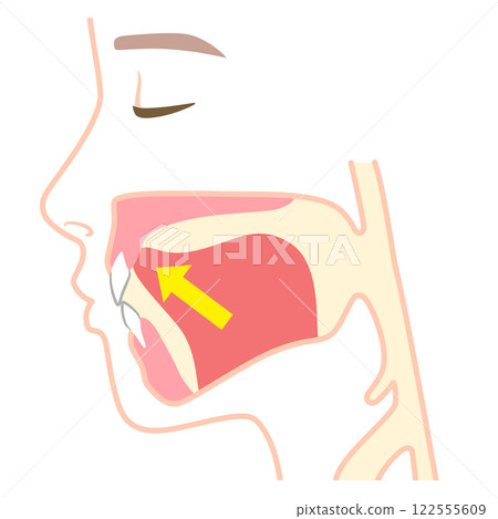 舌頭位置不正確－舌頭位置下垂 122555609