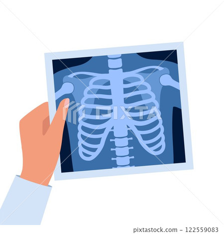 X ray of human skeleton chest and pelvis human bones. Roentgen shot in doctors hand. Medical analyzing. Anatomical bone medicine laboratory radial scan. Vector. X ray of human skeleton chest and pelvis human bones. Roentgen shot in doctors hand. Medical analyzing. Anatomical bone medicine laboratory radial scan. Vector. 122559083