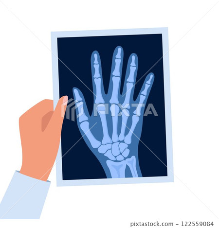 X ray human hand. Body bone roentgen front view. Medical anatomy. Arm checking healthcare joint palm finger exam. Roentgen shot in doctors hand. Vector illustration. 122559084