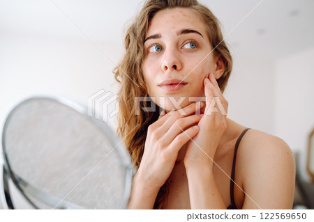 Beautiful woman with problematic skin looks in her small mirror. Cosmetology. Skin care concept. Beautiful woman with problematic skin looks in her small mirror. Cosmetology. Skin care concept. 122569650
