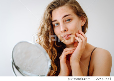 Beautiful woman with problematic skin looks in her small mirror. Cosmetology. Skin care concept. 122569651