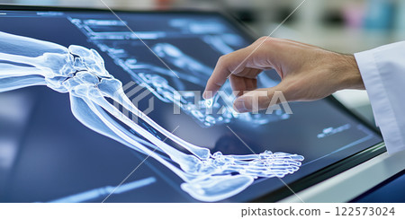 doctor examining MRI scan of foot and ankle on digital screen doctor examining MRI scan of foot and ankle on digital screen 122573024
