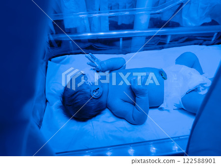 Newborn baby boy under phototherapy lamp. 122588901