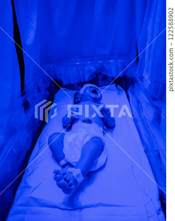 Newborn baby boy under phototherapy lamp. 122588902