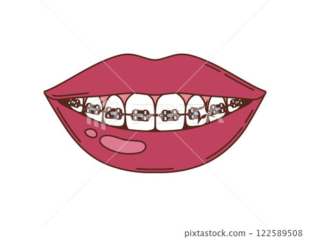 Cartoon groovy smiling lips revealing teeth with braces and wires, symbolizing dental care, orthodontics, oral health, medicine and human body, emphasizing corrective treatment and alignment of teeth Cartoon groovy smiling lips revealing teeth with braces and wires, symbolizing dental care, orthodontics, oral health, medicine and human body, emphasizing corrective treatment and alignment of teeth 122589508
