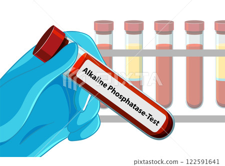 Medical Blood Test Illustration 122591641