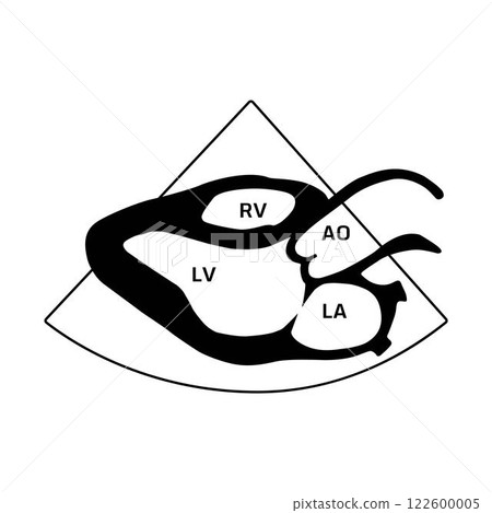 Parasternal long axis view, heart disease 122600005