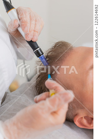 Trichologist doing man improve hair growth procedure, dermapen microneedling, vitamin injections 122614692