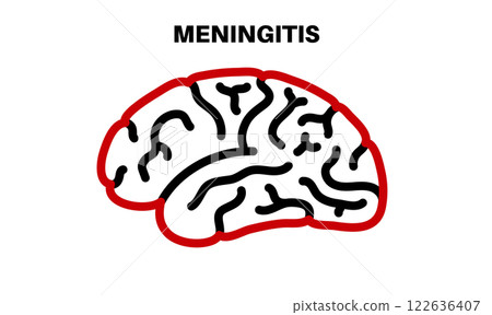 Meningitis medical poster Meningitis medical poster 122636407
