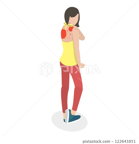 3D Isometric Flat  Illustration of Skin Acne And Allergy. Item 1 122643851