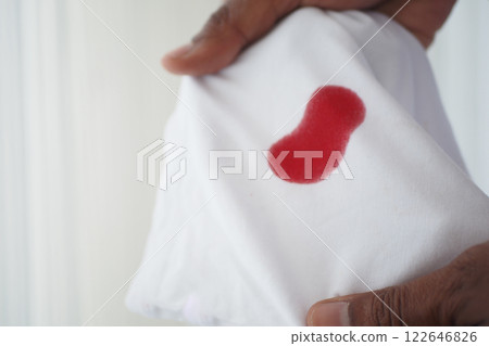 blood stains on a white shirt. 122646826