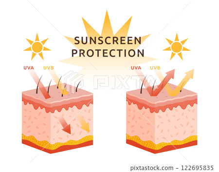 Protect skin from UV sun. Rays arrow damage. UVA and UVB reflecting heat. Structure of layer epidermis. Human body. Dermis section chart. Sunscreen protection infographic. Vector garish illustration 122695835