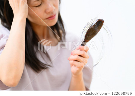 女性禿頭 FAGA 122698799