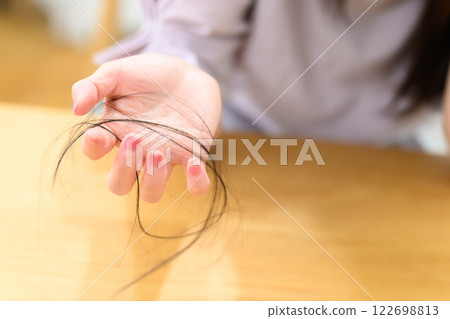 Female hair loss alopecia FAGA Female hair loss alopecia FAGA 122698813
