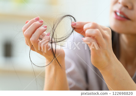 女性禿頭 FAGA 122698820