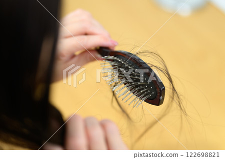 女性禿頭 FAGA 122698821