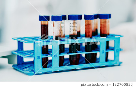 Closeup blood, test tube or medical research in science laborary for testing, checking or examining DNA sample. Searching for breakthrough cure for marburg virus, monkeypox or global pandemic disease 122700833