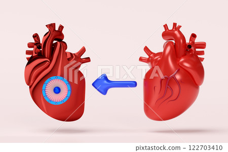 3d artificial heart with realistic human heart isolated on pink background. Future innovation, heart transplantation concept, 3d illustration render 3d artificial heart with realistic human heart isolated on pink background. Future innovation, heart transplantation concept, 3d illustration render 122703410