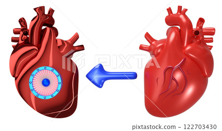 3d artificial heart with realistic human heart isolated. Future innovation, heart transplantation concept, 3d illustration render 122703430