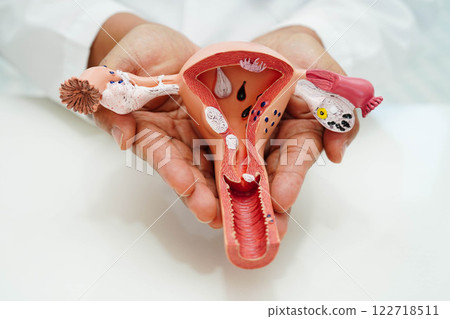 Uterus, doctor holding human anatomy model for study diagnosis and treatment in hospital. 122718511