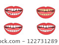 A set of healthy and troubled mouths 122731289