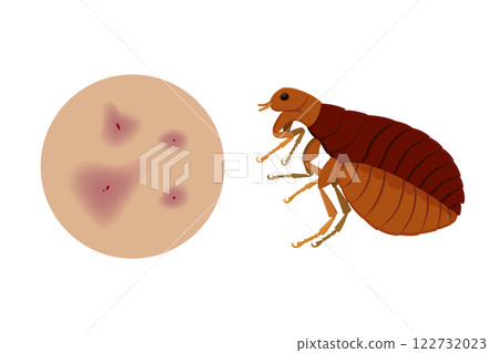 Flea causing skin irritation and itching sensation Flea causing skin irritation and itching sensation 122732023