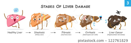 Stages of liver damage . Collection of cute medical cartoon characters about progression of liver disease . Vector . Stages of liver damage . Collection of cute medical cartoon characters about progression of liver disease . Vector . 122761829