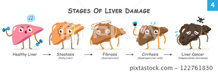Stages of liver damage . Collection of cute medical cartoon characters about progression of liver disease . Vector . Stages of liver damage . Collection of cute medical cartoon characters about progression of liver disease . Vector . 122761830