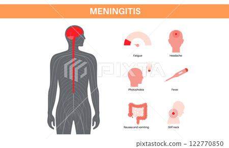 Meningitis medical poster 122770850