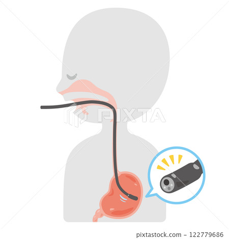 A simple profile illustration of a person undergoing a gastroscopy examination 122779686