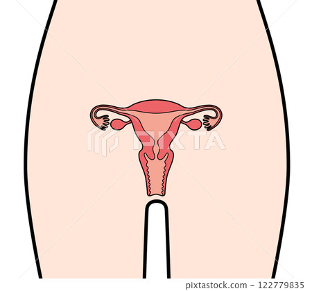 人類子宮 122779835