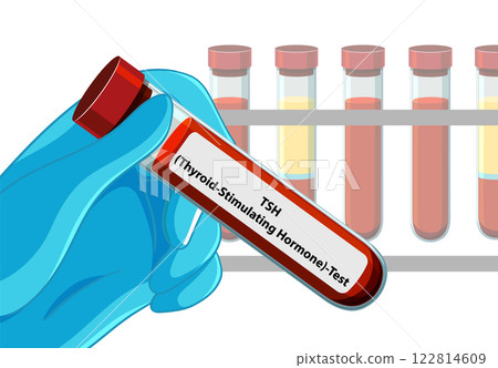 Medical Blood Test Illustration 122814609