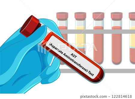 Medical Blood Test Illustration 122814618