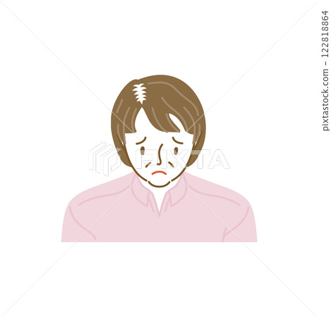 Front view of a middle-aged woman with thinning hair (top view) 122818864