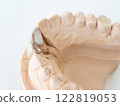 Full crown, front tooth crown, dental insurance treatment, model included 122819053