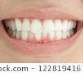 Teeth Whitening Dentistry Human Model 122819416