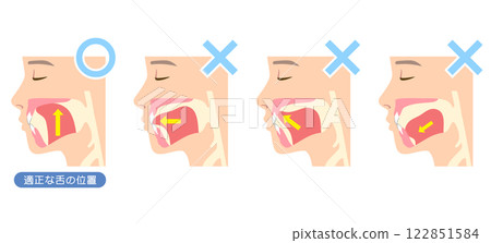 How to mew properly: correct and incorrect tongue position 122851584