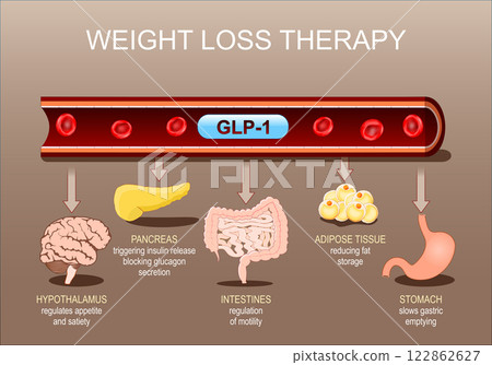 Weight loss therapy and GLP-1 122862627