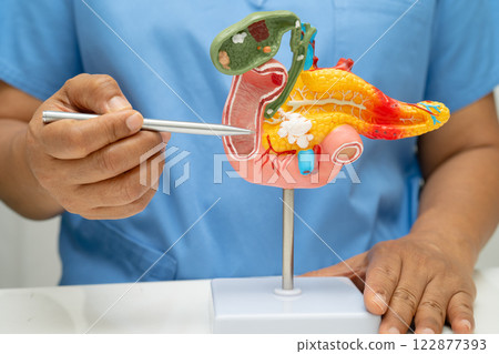 Pancreatitis, pancreatic cancer, Asian doctor with pancreas, gallbladder and bile duct human anatomy model at hospital. 122877393
